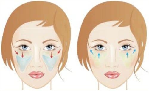 Schema-lipofilling-visage