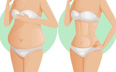 Mommy Makeover en Tunisie: retrouvez votre corps d’avant grossesse en une seule opération esthétique