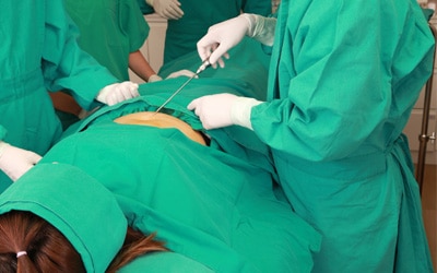 Une femme sur table opératoire en train de faire une opération de liposuccion