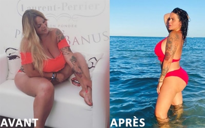 Sarah Fraisou chirurgie esthetique avant apres 1