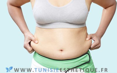 Quelles alternatives à la liposuccion ?