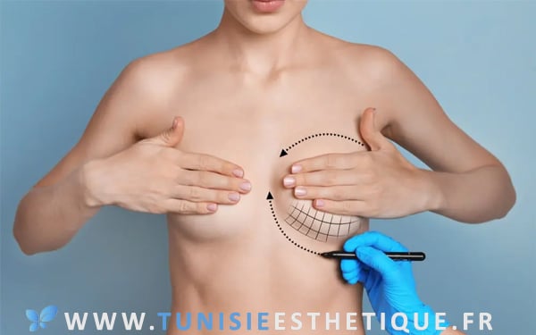 Femme avec petite poitrine en préparation à une chirurgie esthétique