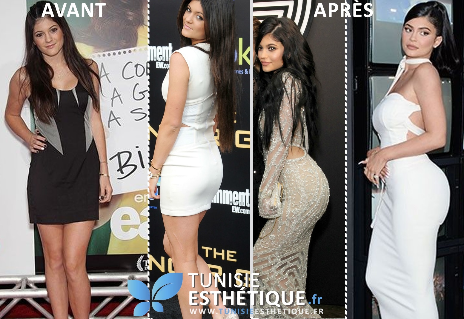 Kylie jenner corps avant apres