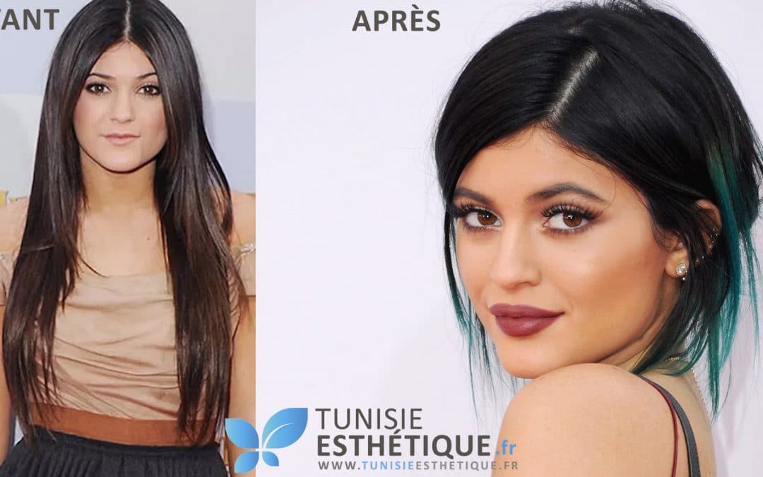 Kylie Jenner : l’avant et l’après chirurgie esthétique