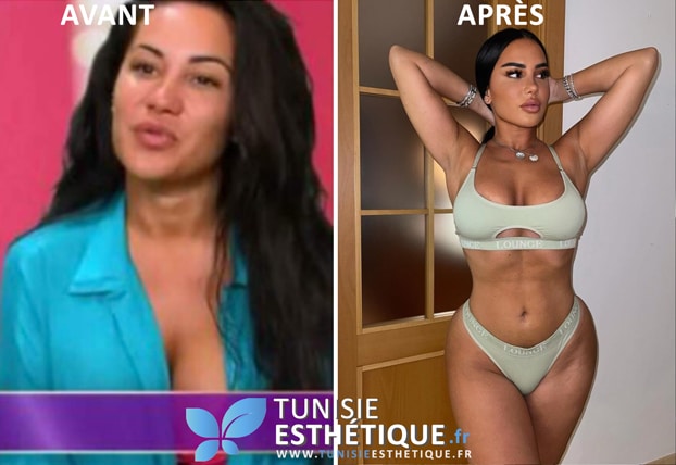 Milla Jasmin avant et Apres Photo 1