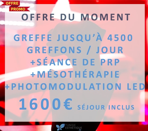 Promo greffe de cheveux Tunisie Esthetique