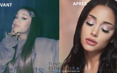 Ariana Grande : avant et après chirurgie esthétique