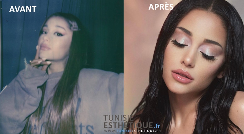 Ariana Grande Avant apres chirurgie esthetique