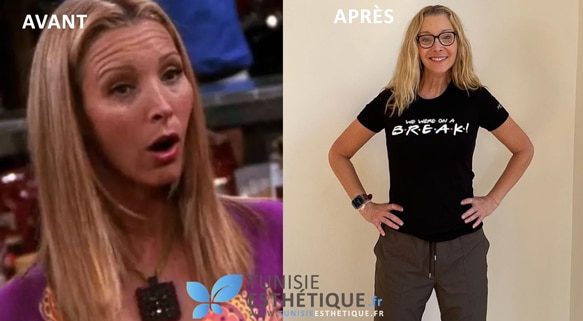 Lisa Kudrow avant apres