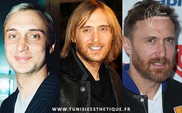 l'évolution physique de david guetta depuis 20 ans