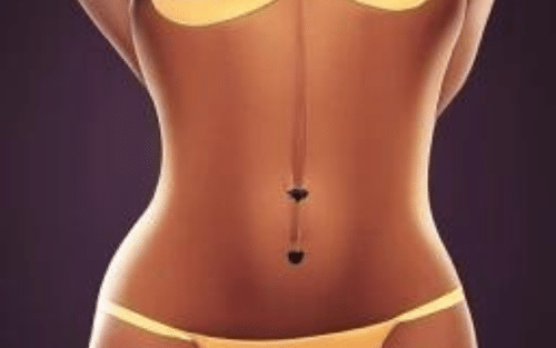 silhouette d'une femme ayant réalisée une liposuccion du pubis