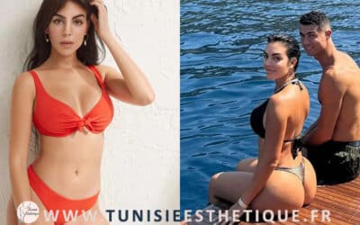 Georgina Rodriguez et la chirurgie esthétique