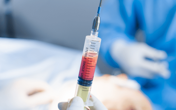 Lipofilling Lipofilling