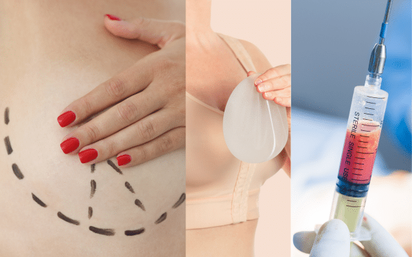 Comment choisir la bonne technique pour refaire ma poitrine : implants, lipofilling ou lifting ?